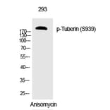 Western blot - Tuberin (Phospho-Ser939) Polyclonal Antibody from Signalway Antibody (12308) - Antibodies.com