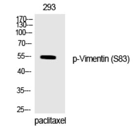 Western blot - Vimentin (Phospho-Ser83) Polyclonal Antibody from Signalway Antibody (12333) - Antibodies.com