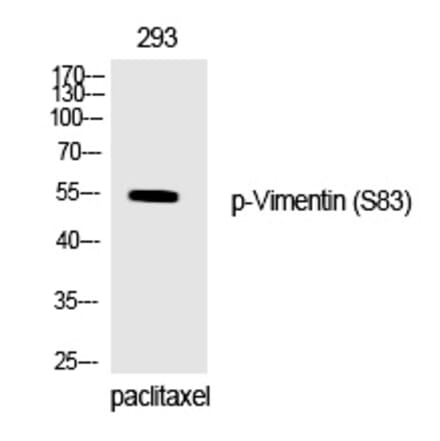 Western blot - Vimentin (Phospho-Ser83) Polyclonal Antibody from Signalway Antibody (12333) - Antibodies.com