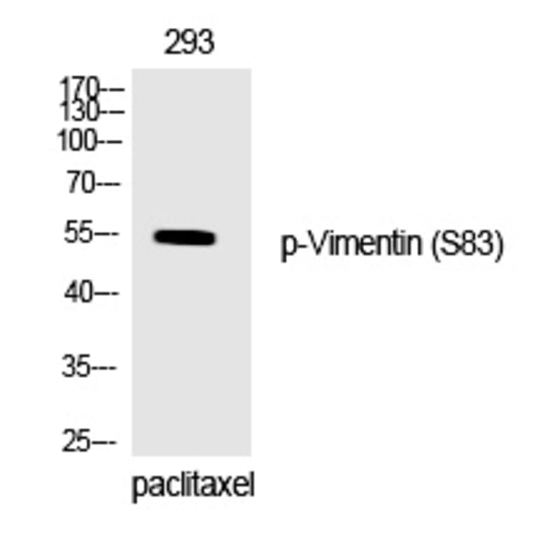 Western blot - Vimentin (Phospho-Ser83) Polyclonal Antibody from Signalway Antibody (12333) - Antibodies.com