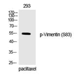 Western blot - Vimentin (Phospho-Ser83) Polyclonal Antibody from Signalway Antibody (12333) - Antibodies.com