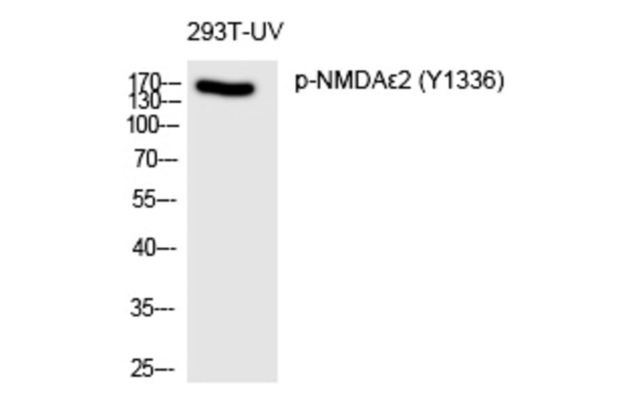 Western blot - NMDAε2 (Phospho-Tyr1336) Polyclonal Antibody from Signalway Antibody (12342) - Antibodies.com