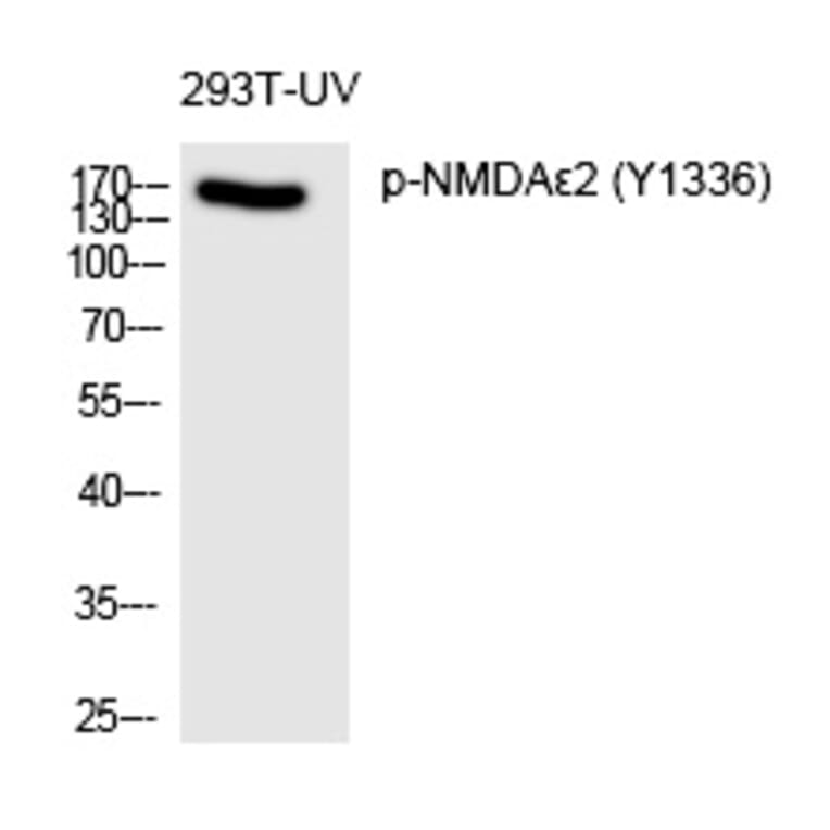 Western blot - NMDAε2 (Phospho-Tyr1336) Polyclonal Antibody from Signalway Antibody (12342) - Antibodies.com