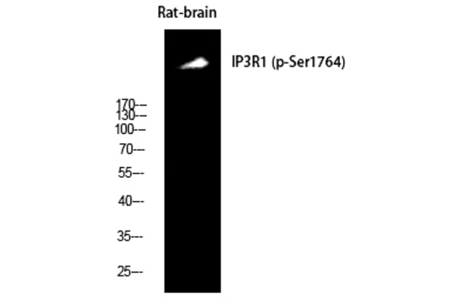 Western blot - IP3R-I (Phospho-Ser1764) Polyclonal Antibody from Signalway Antibody (12382) - Antibodies.com