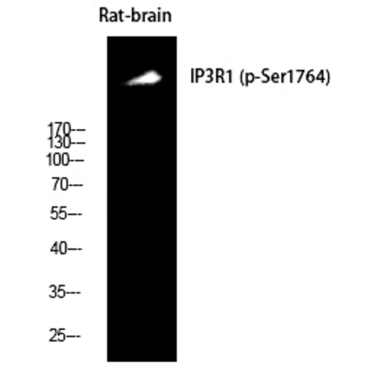 Western blot - IP3R-I (Phospho-Ser1764) Polyclonal Antibody from Signalway Antibody (12382) - Antibodies.com