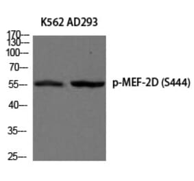 Western blot - MEF-2D (Phospho-Ser444) Polyclonal Antibody from Signalway Antibody (12205) - Antibodies.com