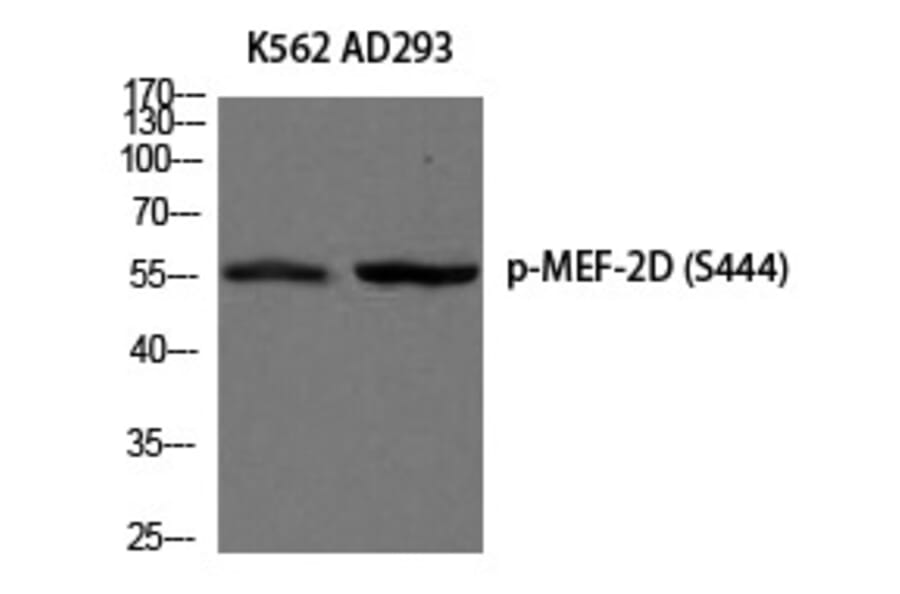 Western blot - MEF-2D (Phospho-Ser444) Polyclonal Antibody from Signalway Antibody (12205) - Antibodies.com