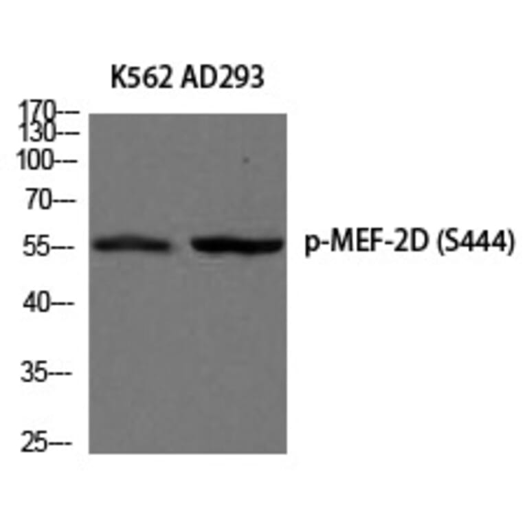 Western blot - MEF-2D (Phospho-Ser444) Polyclonal Antibody from Signalway Antibody (12205) - Antibodies.com