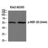 Western blot - MEF-2D (Phospho-Ser444) Polyclonal Antibody from Signalway Antibody (12205) - Antibodies.com