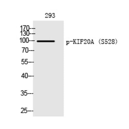 Western blot - KIF20A (Phospho-Ser528) Polyclonal Antibody from Signalway Antibody (12245) - Antibodies.com
