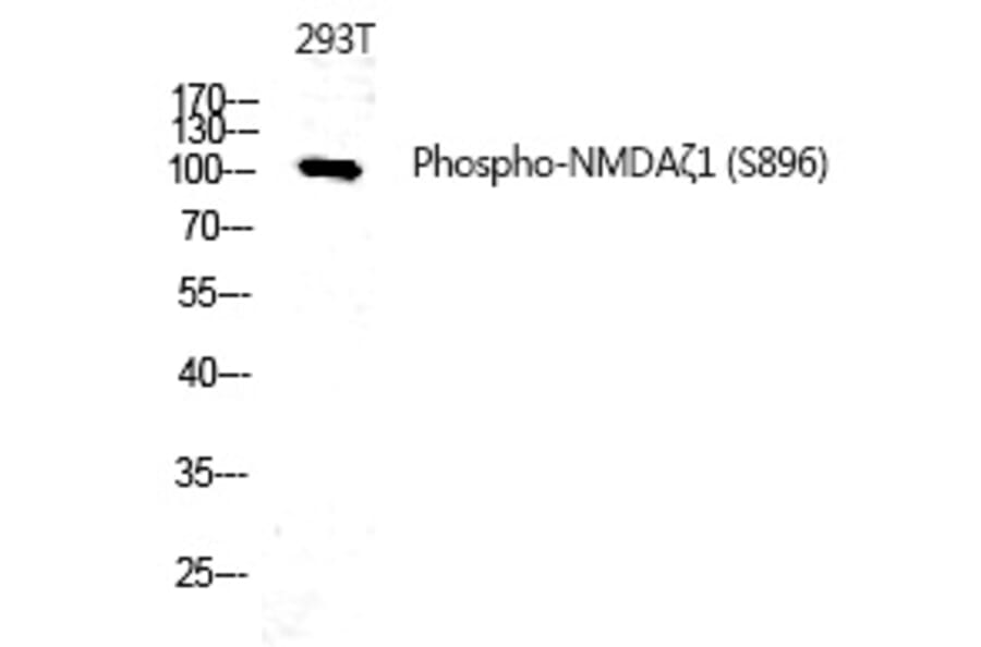 Western blot - NMDAζ1 (Phospho-Ser896) Polyclonal Antibody from Signalway Antibody (12314) - Antibodies.com
