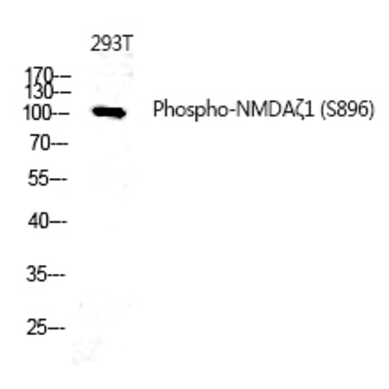 Western blot - NMDAζ1 (Phospho-Ser896) Polyclonal Antibody from Signalway Antibody (12314) - Antibodies.com