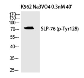 Western blot - SLP-76 (Phospho-Tyr128) Polyclonal Antibody from Signalway Antibody (12341) - Antibodies.com