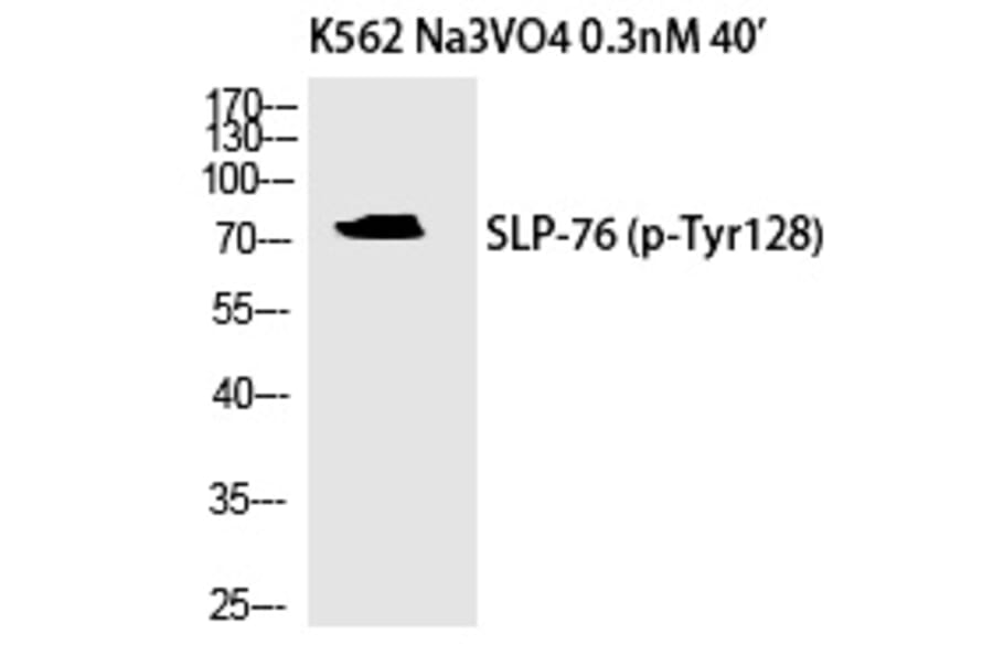 Western blot - SLP-76 (Phospho-Tyr128) Polyclonal Antibody from Signalway Antibody (12341) - Antibodies.com