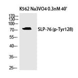 Western blot - SLP-76 (Phospho-Tyr128) Polyclonal Antibody from Signalway Antibody (12341) - Antibodies.com