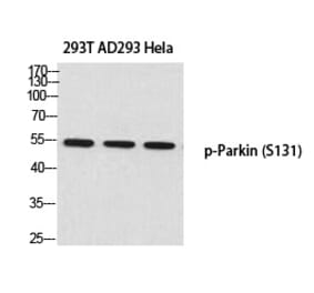 Western blot - Parkin (Phospho-Ser131) Polyclonal Antibody from Signalway Antibody (12371) - Antibodies.com