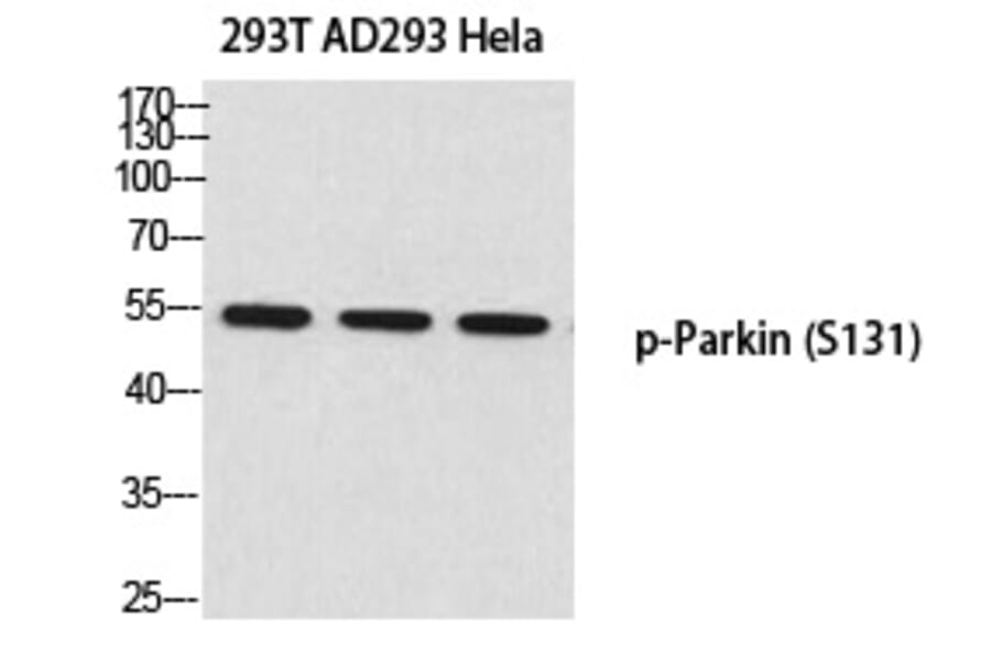 Western blot - Parkin (Phospho-Ser131) Polyclonal Antibody from Signalway Antibody (12371) - Antibodies.com