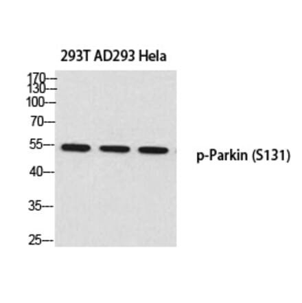Western blot - Parkin (Phospho-Ser131) Polyclonal Antibody from Signalway Antibody (12371) - Antibodies.com