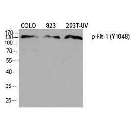 Western blot - Flt-1 (Phospho-Tyr1048) Polyclonal Antibody from Signalway Antibody (12380) - Antibodies.com