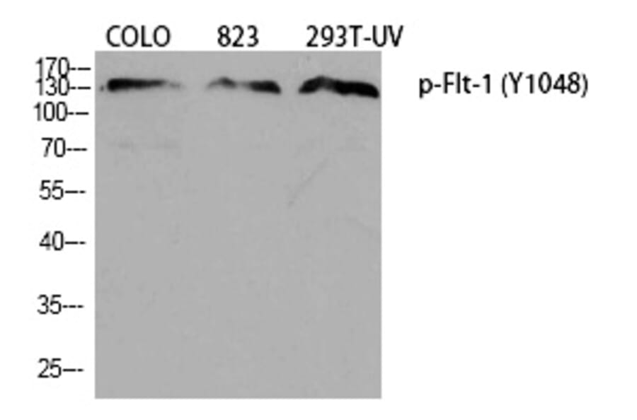 Western blot - Flt-1 (Phospho-Tyr1048) Polyclonal Antibody from Signalway Antibody (12380) - Antibodies.com