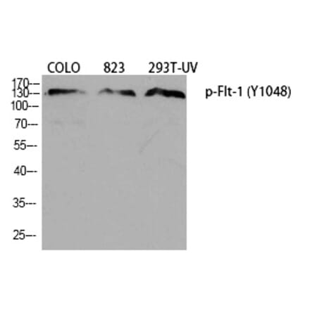 Western blot - Flt-1 (Phospho-Tyr1048) Polyclonal Antibody from Signalway Antibody (12380) - Antibodies.com