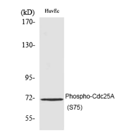 Western blot - Cdc25A (Phospho-Ser75) Polyclonal Antibody from Signalway Antibody (12188) - Antibodies.com