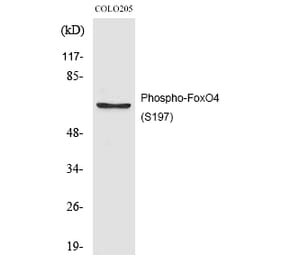 Western blot - FoxO4 (Phospho-Ser197) Polyclonal Antibody from Signalway Antibody (12200) - Antibodies.com