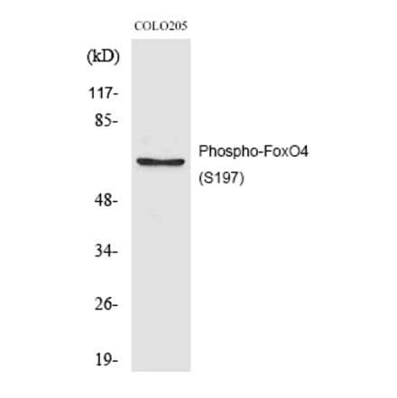 Western blot - FoxO4 (Phospho-Ser197) Polyclonal Antibody from Signalway Antibody (12200) - Antibodies.com