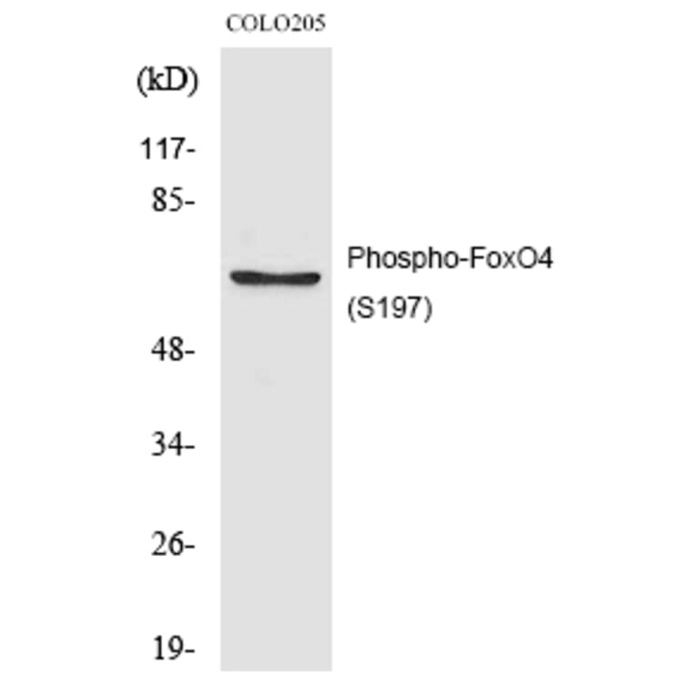 Western blot - FoxO4 (Phospho-Ser197) Polyclonal Antibody from Signalway Antibody (12200) - Antibodies.com