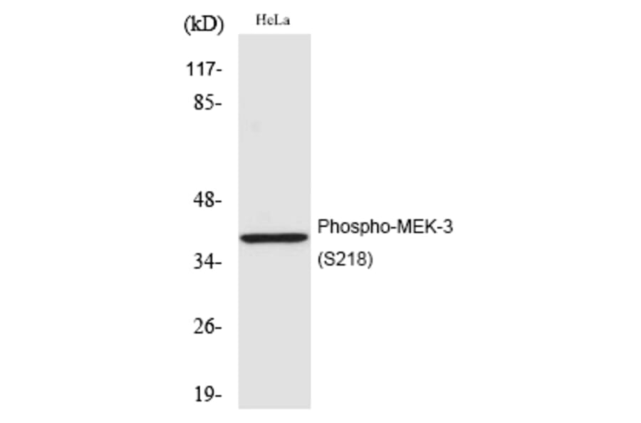 Western blot - MEK-3 (Phospho-Ser218) Polyclonal Antibody from Signalway Antibody (12206) - Antibodies.com