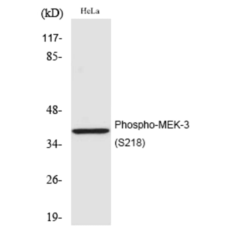 Western blot - MEK-3 (Phospho-Ser218) Polyclonal Antibody from Signalway Antibody (12206) - Antibodies.com