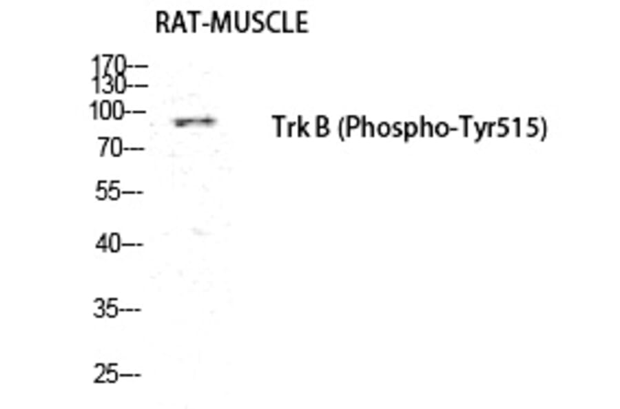 Western blot - Trk B (Phospho-Tyr516) Polyclonal Antibody from Signalway Antibody (12222) - Antibodies.com