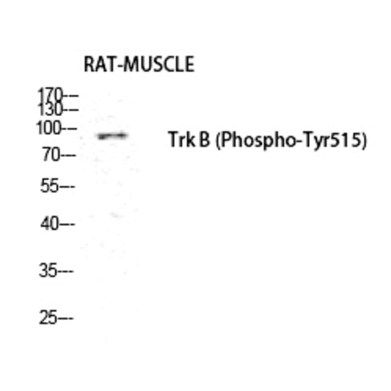 Western blot - Trk B (Phospho-Tyr516) Polyclonal Antibody from Signalway Antibody (12222) - Antibodies.com