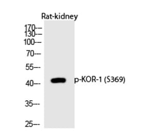 Western blot - KOR-1 (Phospho-Ser369) Polyclonal Antibody from Signalway Antibody (12227) - Antibodies.com