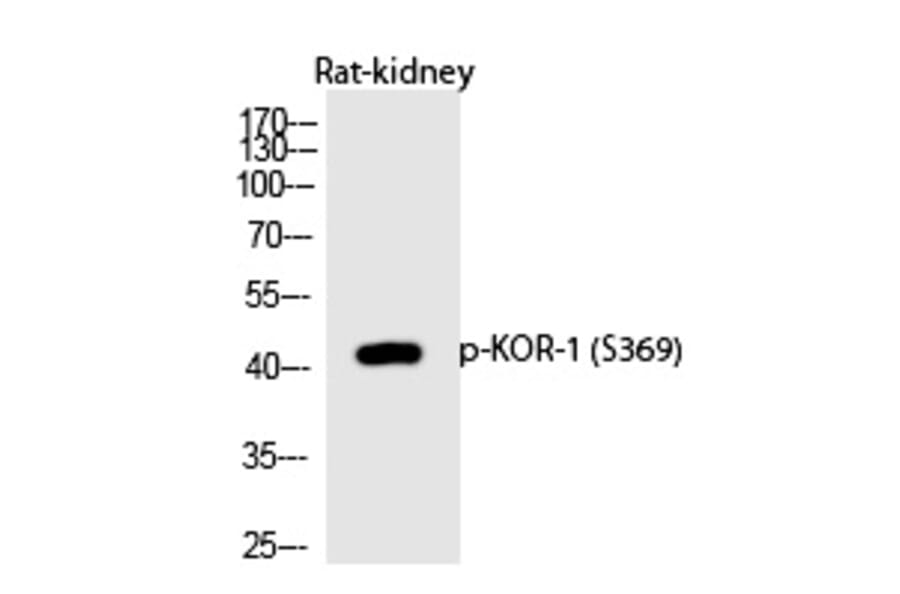 Western blot - KOR-1 (Phospho-Ser369) Polyclonal Antibody from Signalway Antibody (12227) - Antibodies.com