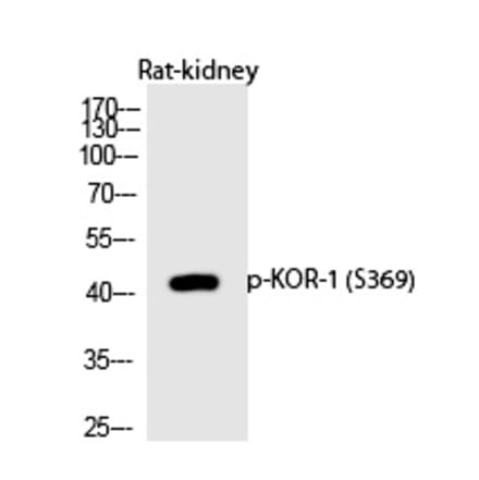 Western blot - KOR-1 (Phospho-Ser369) Polyclonal Antibody from Signalway Antibody (12227) - Antibodies.com