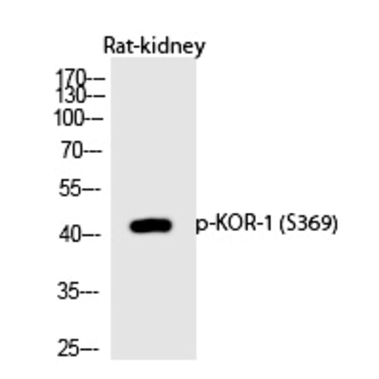 Western blot - KOR-1 (Phospho-Ser369) Polyclonal Antibody from Signalway Antibody (12227) - Antibodies.com