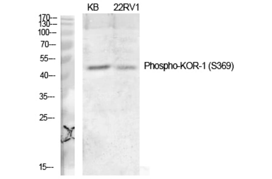 Western blot - KOR-1 (Phospho-Ser369) Polyclonal Antibody from Signalway Antibody (12227) - Antibodies.com