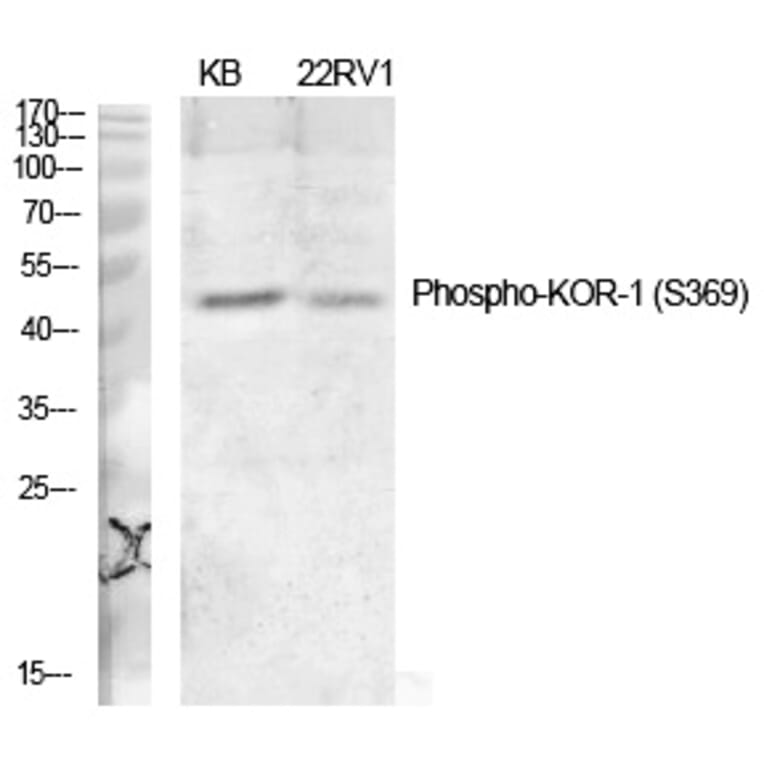 Western blot - KOR-1 (Phospho-Ser369) Polyclonal Antibody from Signalway Antibody (12227) - Antibodies.com