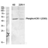 Western blot - KOR-1 (Phospho-Ser369) Polyclonal Antibody from Signalway Antibody (12227) - Antibodies.com