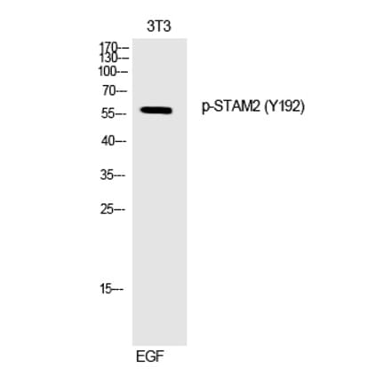 Western blot - STAM2 (Phospho-Tyr192) Polyclonal Antibody from Signalway Antibody (12250) - Antibodies.com