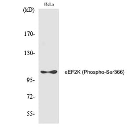 Western blot - eEF2K (Phospho-Ser366) Polyclonal Antibody from Signalway Antibody (12285) - Antibodies.com