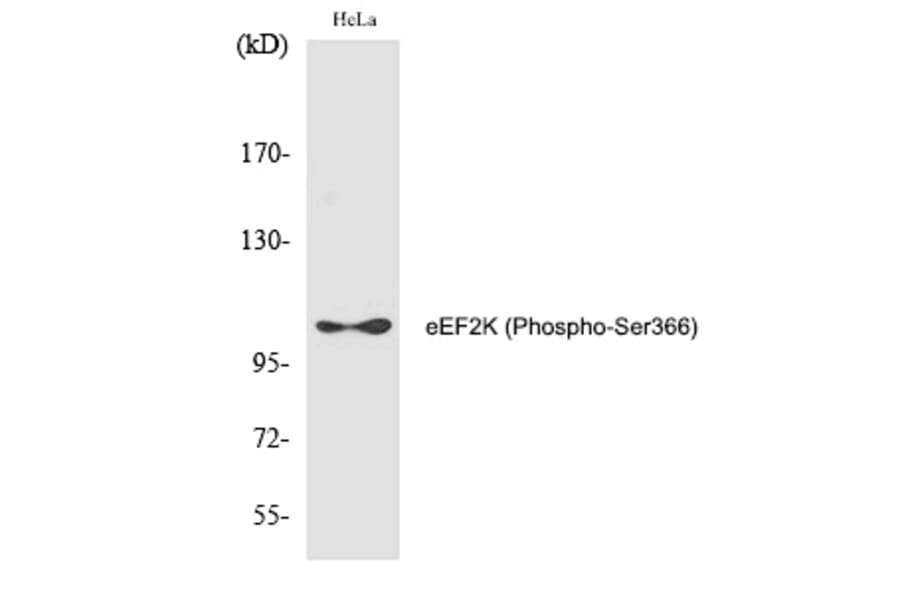 Western blot - eEF2K (Phospho-Ser366) Polyclonal Antibody from Signalway Antibody (12285) - Antibodies.com