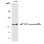 Western blot - eEF2K (Phospho-Ser366) Polyclonal Antibody from Signalway Antibody (12285) - Antibodies.com