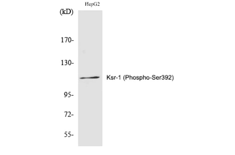 Western blot - Ksr-1 (Phospho-Ser392) Polyclonal Antibody from Signalway Antibody (12288) - Antibodies.com