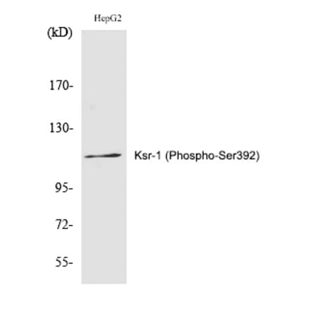Western blot - Ksr-1 (Phospho-Ser392) Polyclonal Antibody from Signalway Antibody (12288) - Antibodies.com