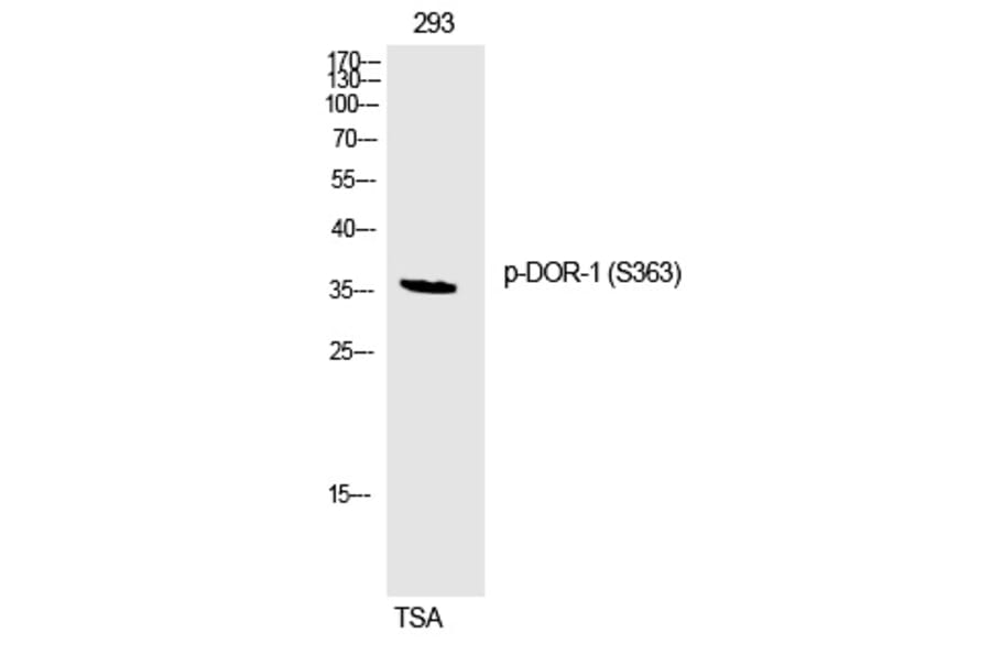 Western blot - DOR-1 (Phospho-Ser363) Polyclonal Antibody from Signalway Antibody (12298) - Antibodies.com