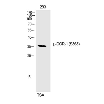 Western blot - DOR-1 (Phospho-Ser363) Polyclonal Antibody from Signalway Antibody (12298) - Antibodies.com