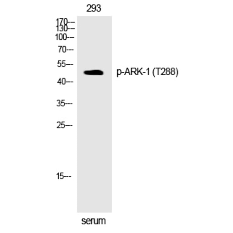 Western blot - ARK-1 (Phospho-Thr288) Polyclonal Antibody from Signalway Antibody (12301) - Antibodies.com
