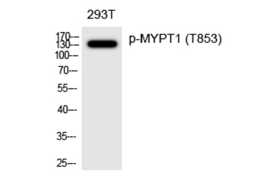 Western blot - MYPT1 (Phospho-Thr853) Polyclonal Antibody from Signalway Antibody (12302) - Antibodies.com